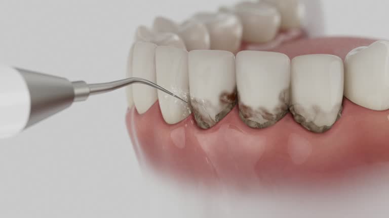 Reliable Dental contractor in Stockton, MO by Dentist Open Now
